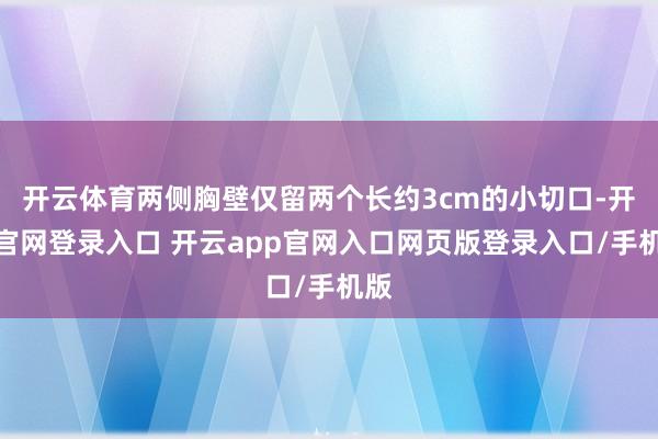 开云体育两侧胸壁仅留两个长约3cm的小切口-开云官网登录入口 开云app官网入口网页版登录入口/手机版